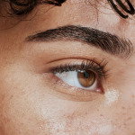 botox forehead eyebrows
