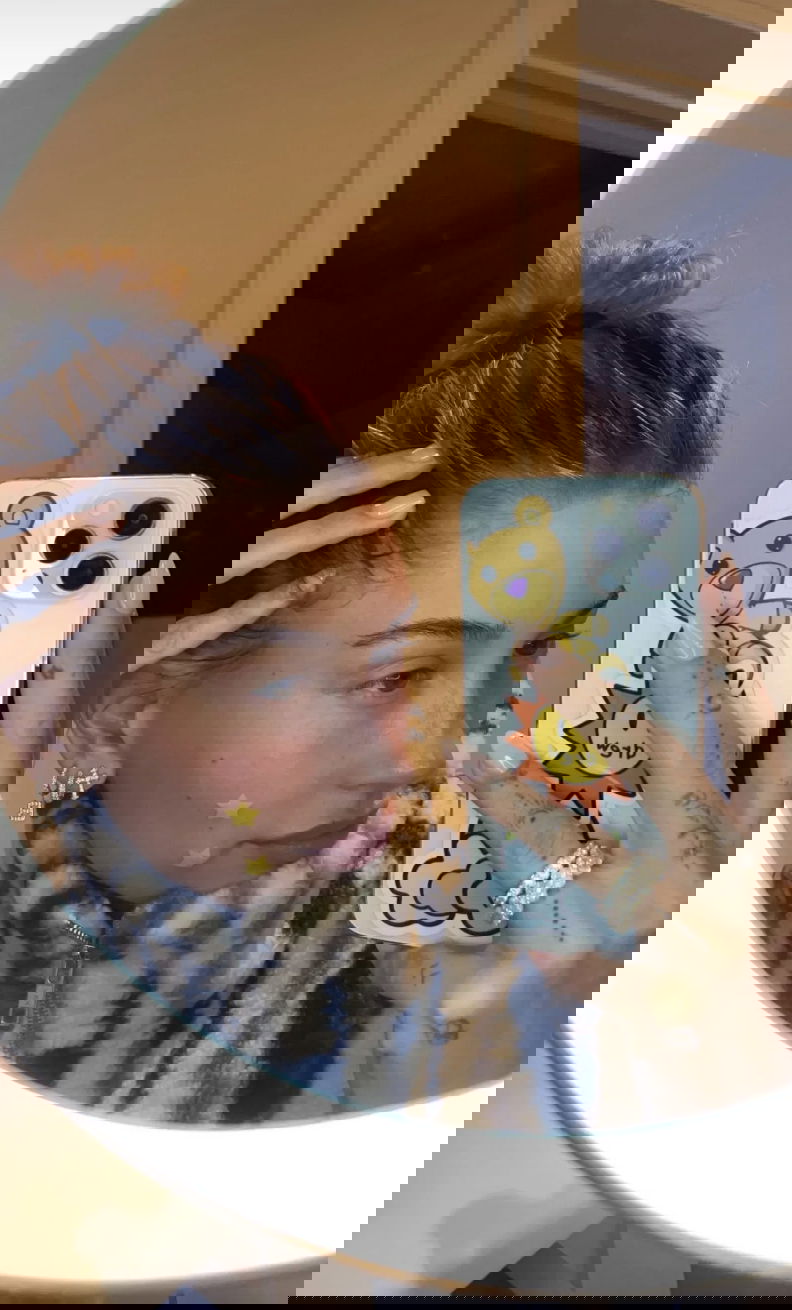 Hailey Bieber using a pimple patch