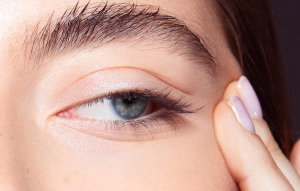 where on your face can you get Botox woman eye wrinkles