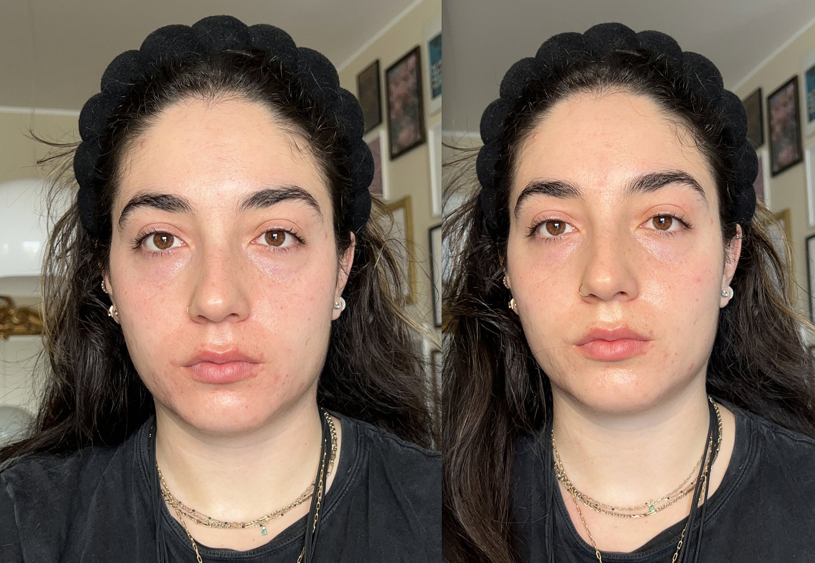 before-and-after | Live That Glow