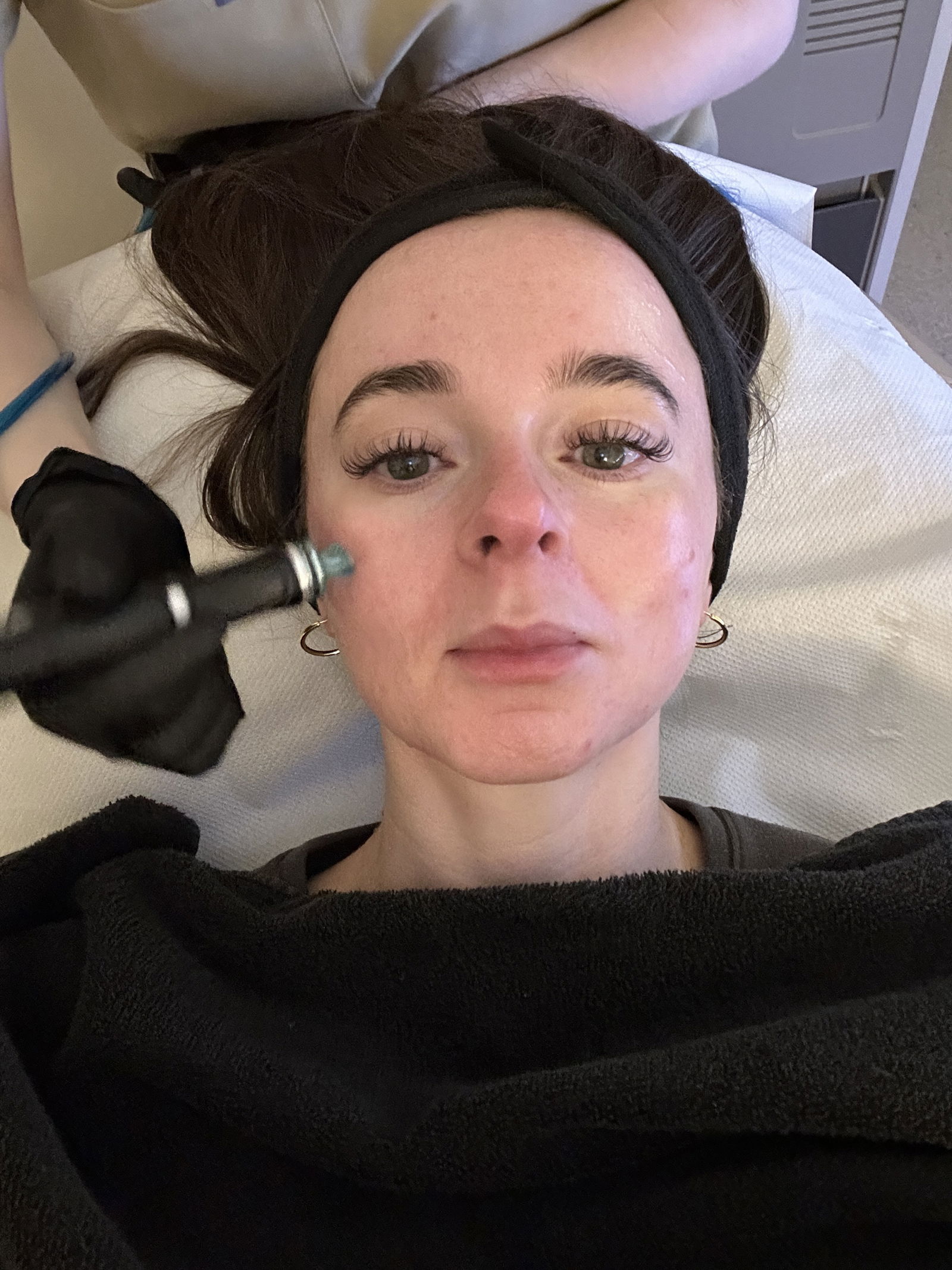 Grace's skin is cleaned during the HydraFacial