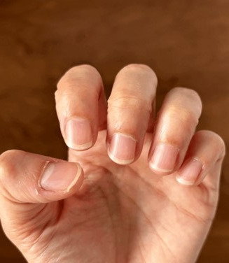 biting nails nail growth products
