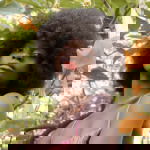 what is hyperpigmentation