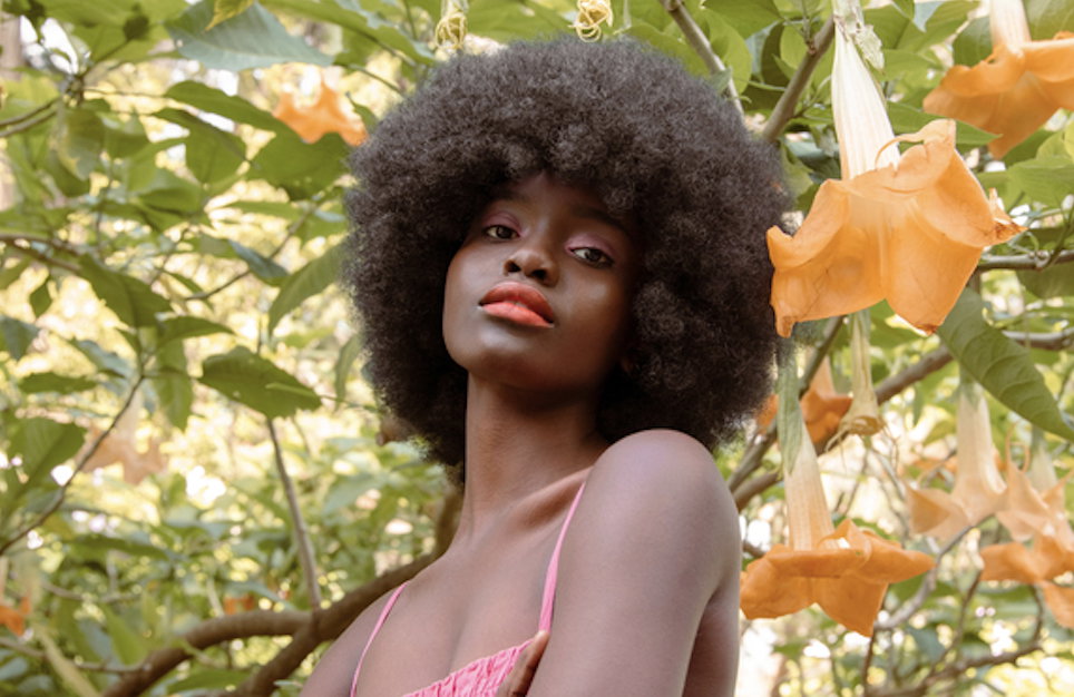 what is hyperpigmentation