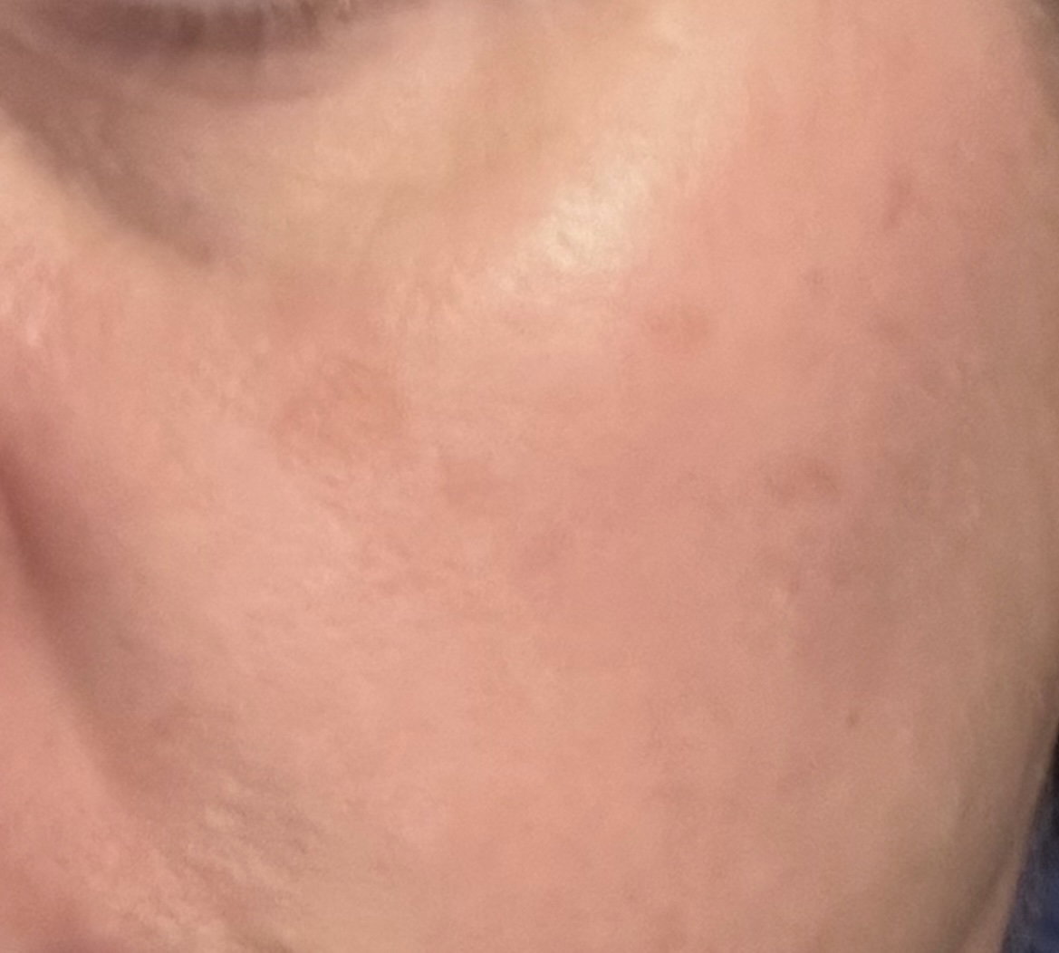 Ole Henriksen Dewtopia 20 Acid Night Treatment 1