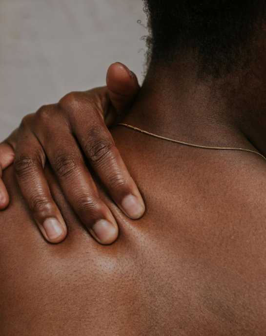 what is hyperpigmentation
