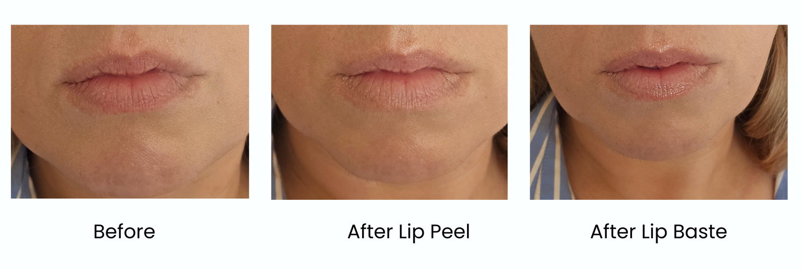 | Live That Glow Dr Idriss Barrier Baste Lip Basting Duo before and after images