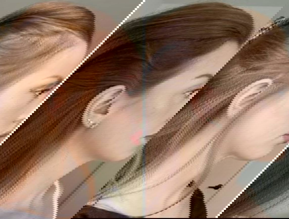 Woman with hair growth showing before and after using CurrentBody's LED Hair Growth Helmet