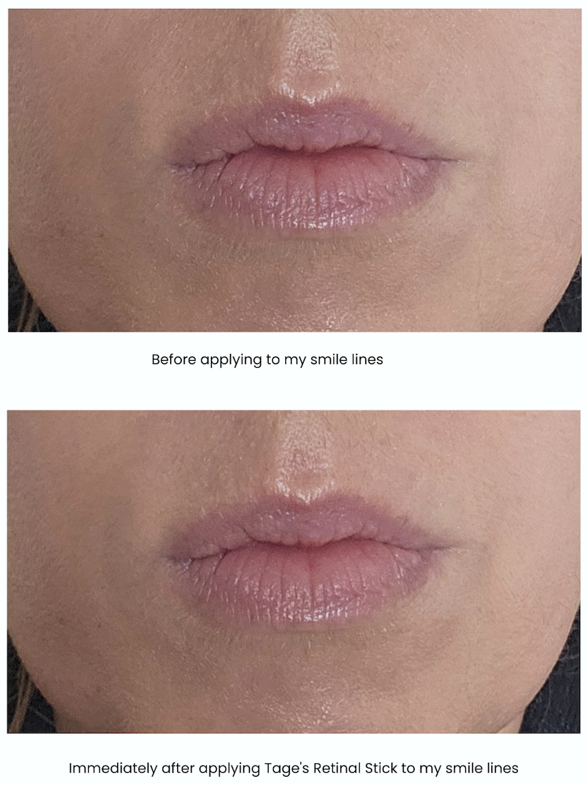 Before-and-after close-up photographs of smile lines showing the skin before and immediately after applying Tage Vita A Retinal Multi Balm Stick over tinted SPF.